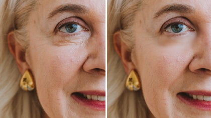 Older woman’s face shown with wrinkles softened using a facial touch up feature
